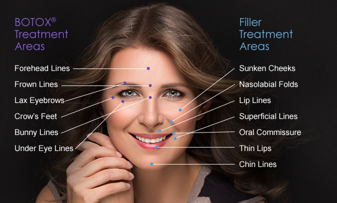 Difference Between Botox and Dermal Fillers